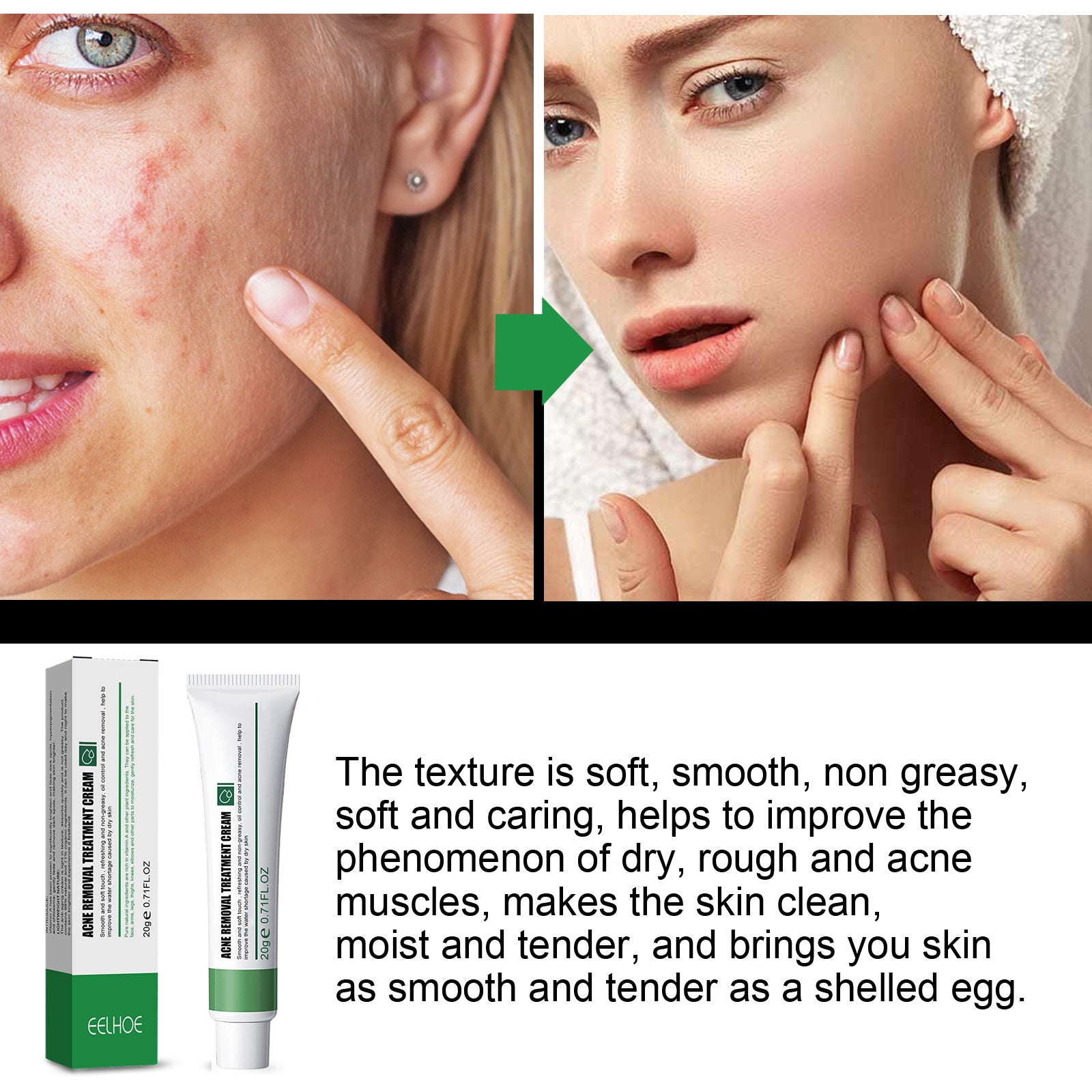 Clarity Blemish Cream™