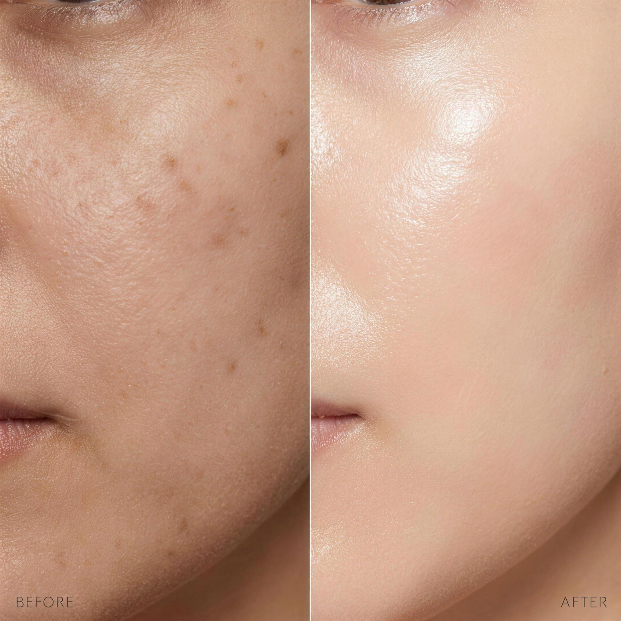 Before and after