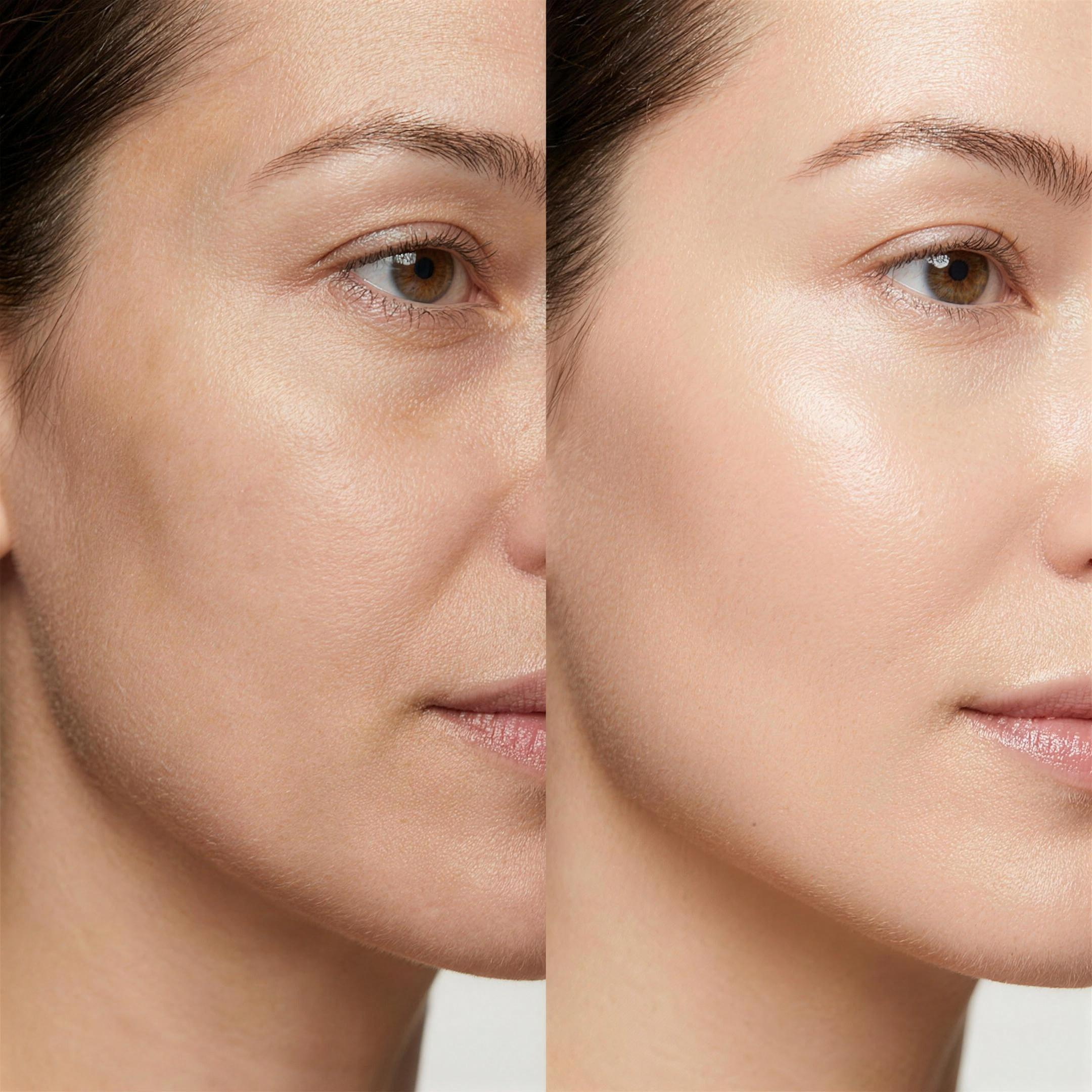 Before and after